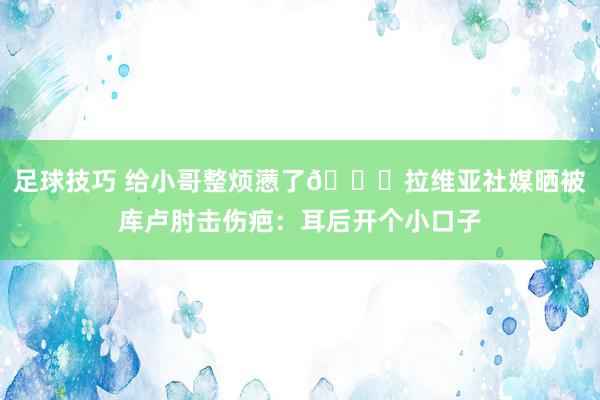 足球技巧 给小哥整烦懑了😅拉维亚社媒晒被库卢肘击伤疤：耳后开个小口子